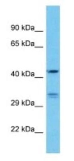 KRT33A Rabbit anti-Human, Polyclonal, Novus Biologicals:Antibodies:Primary